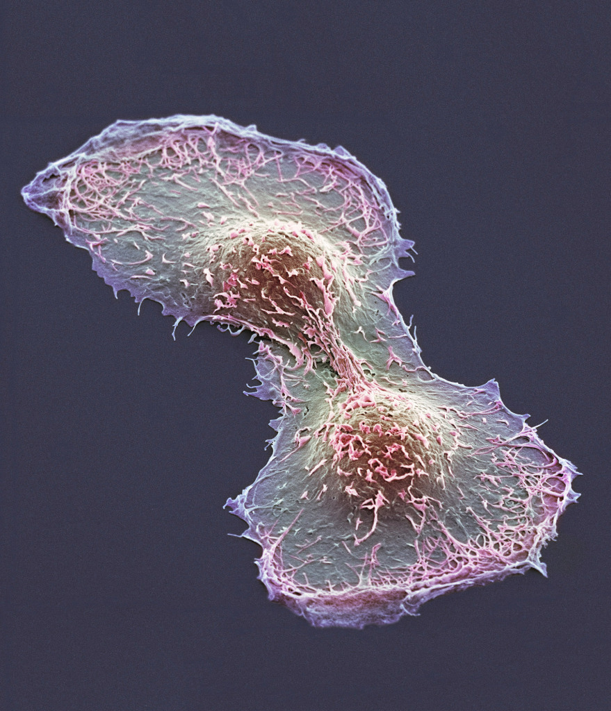 HeLa cell division, SEM