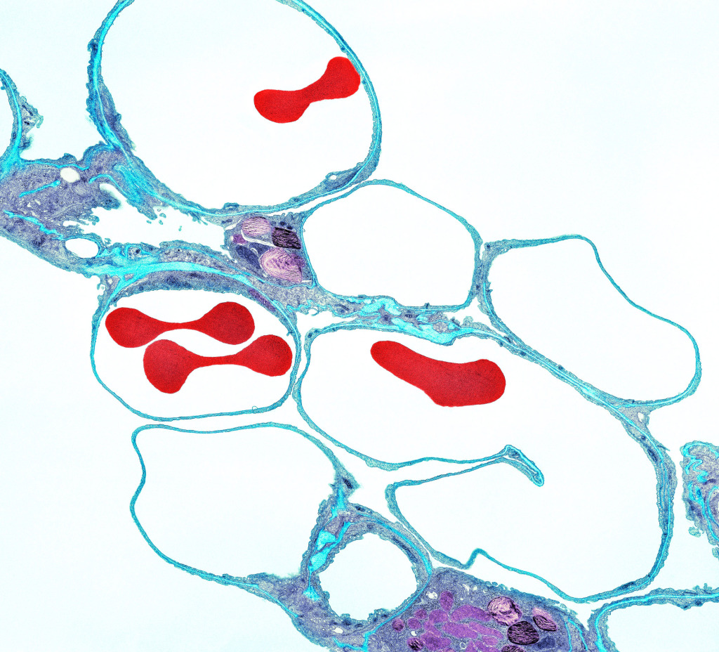Lung alveoli and red blood cells, TEM