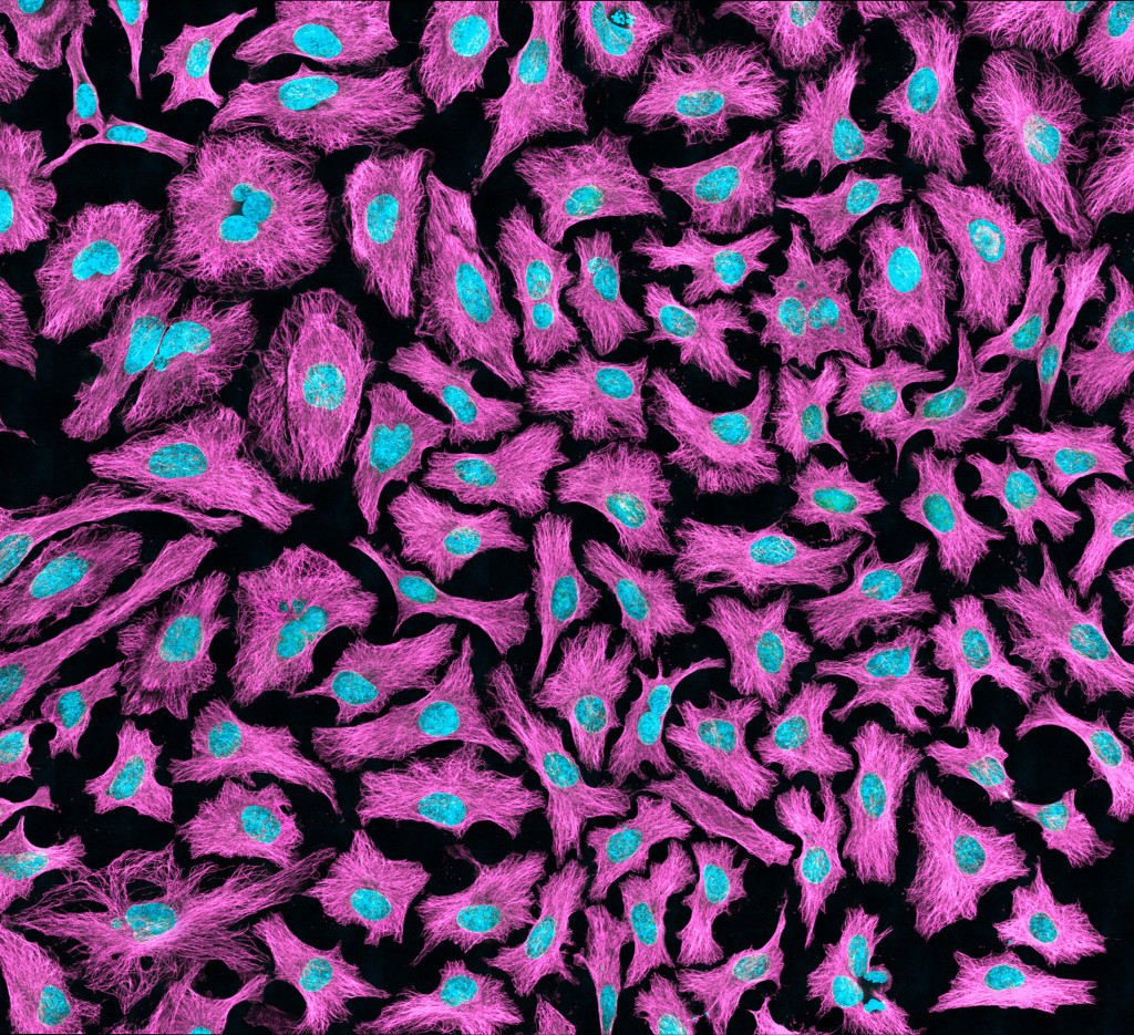 HeLa cells, light micrograph