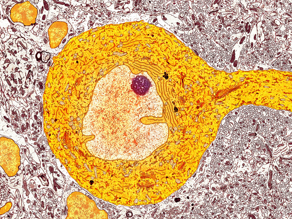 Purkinje nerve cell, TEM