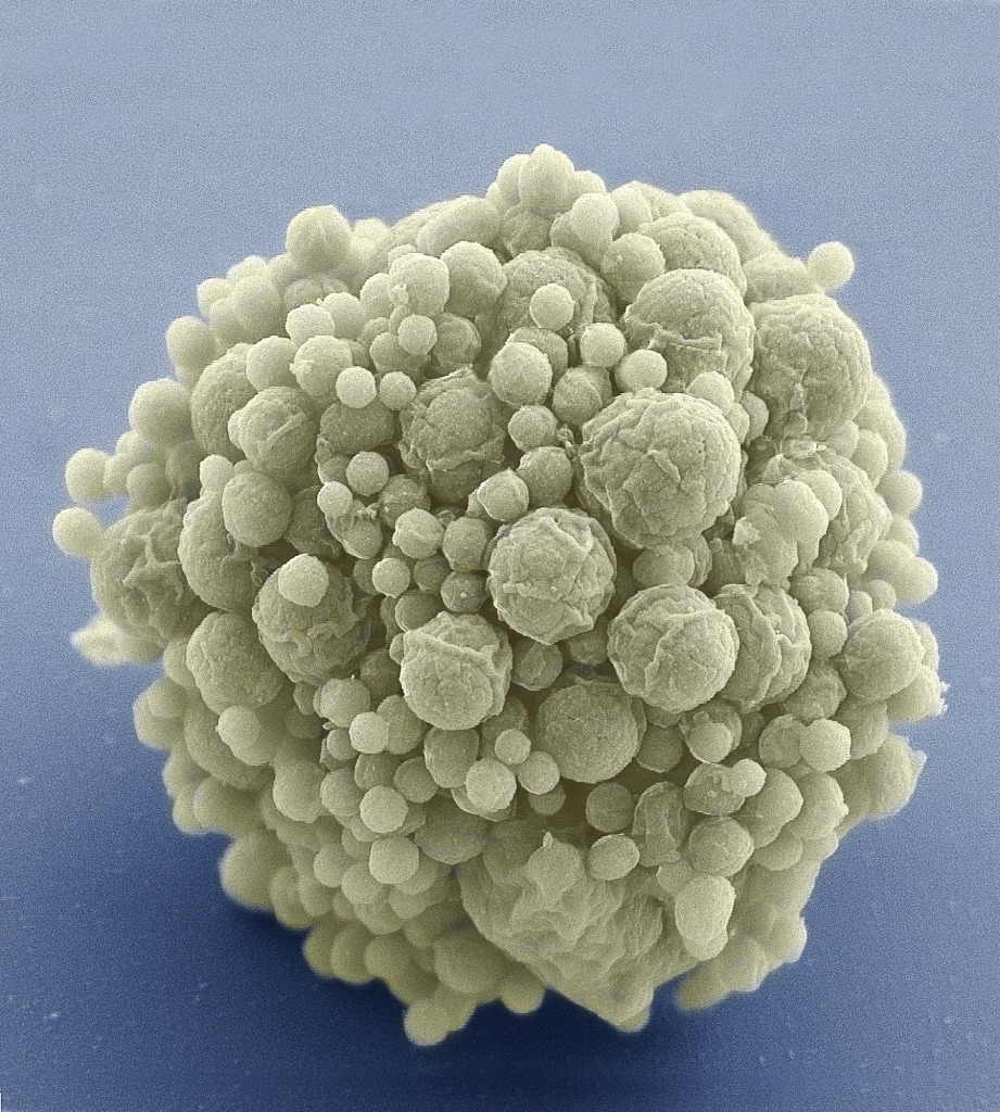 Mycoplasma mycoides JCVI Syn 3.0, SEM
