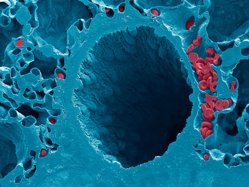 Lung bronchiole, SEM