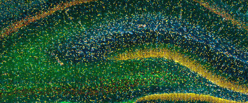 Hippocampus brain tissue liight micrograph