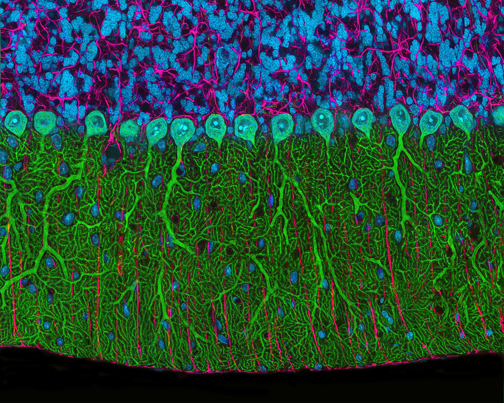 Cerebellum from a brain. Confocal light microscopy