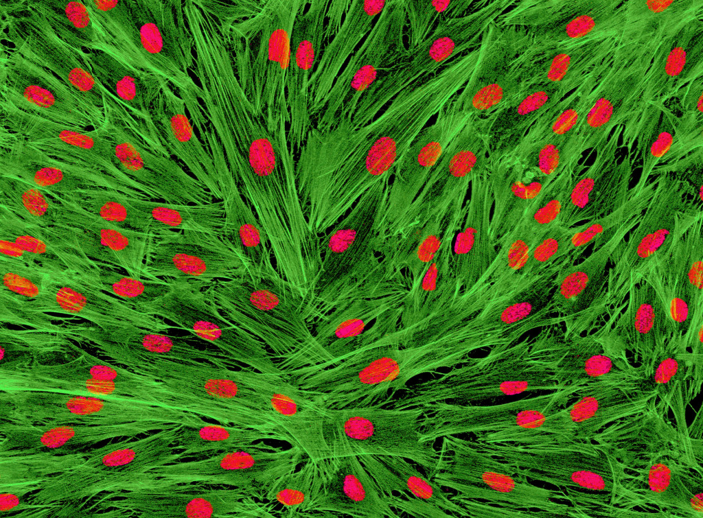Fibroblast cells, light micrograph