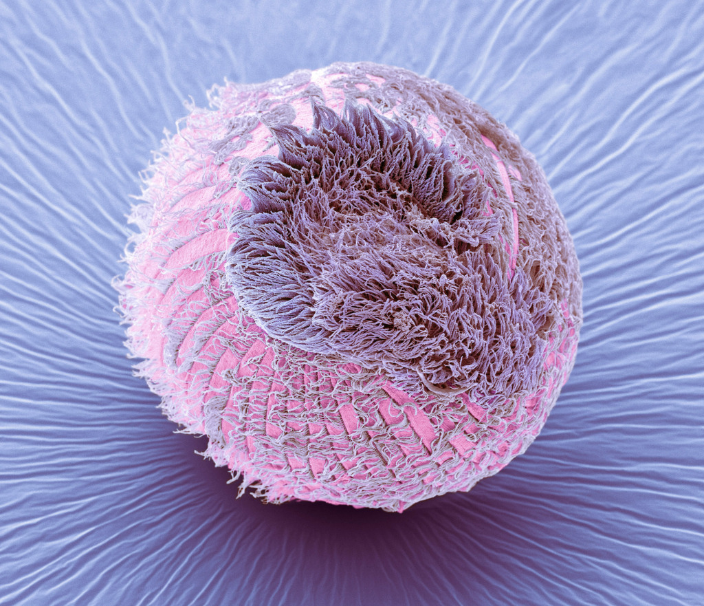 Climacostomum protozoan, SEM