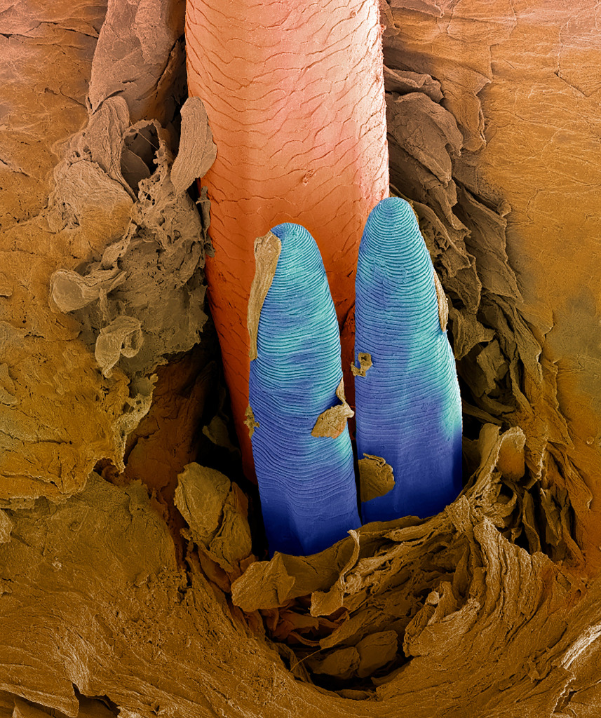 Eyelash mites, SEM