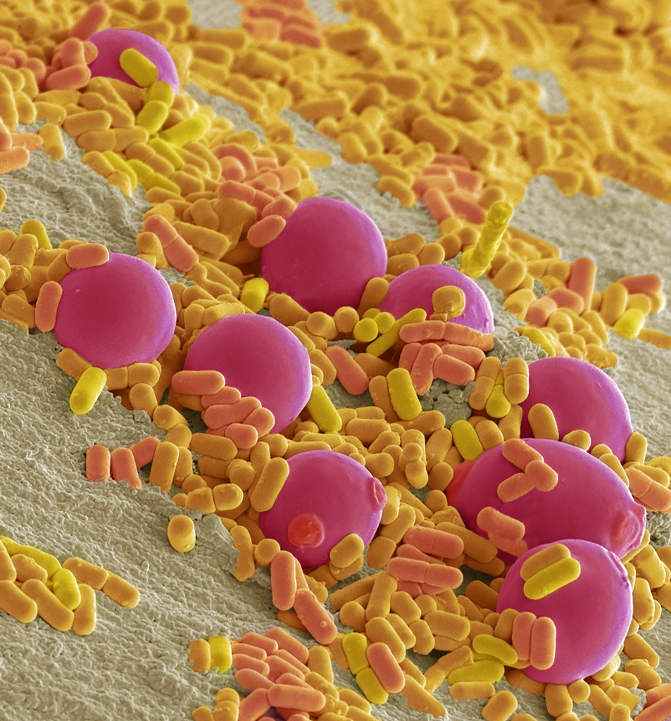 Probiotic flora, SEM