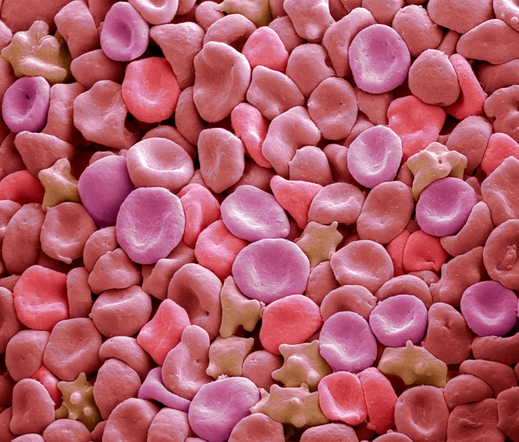 Red blood cells, SEM