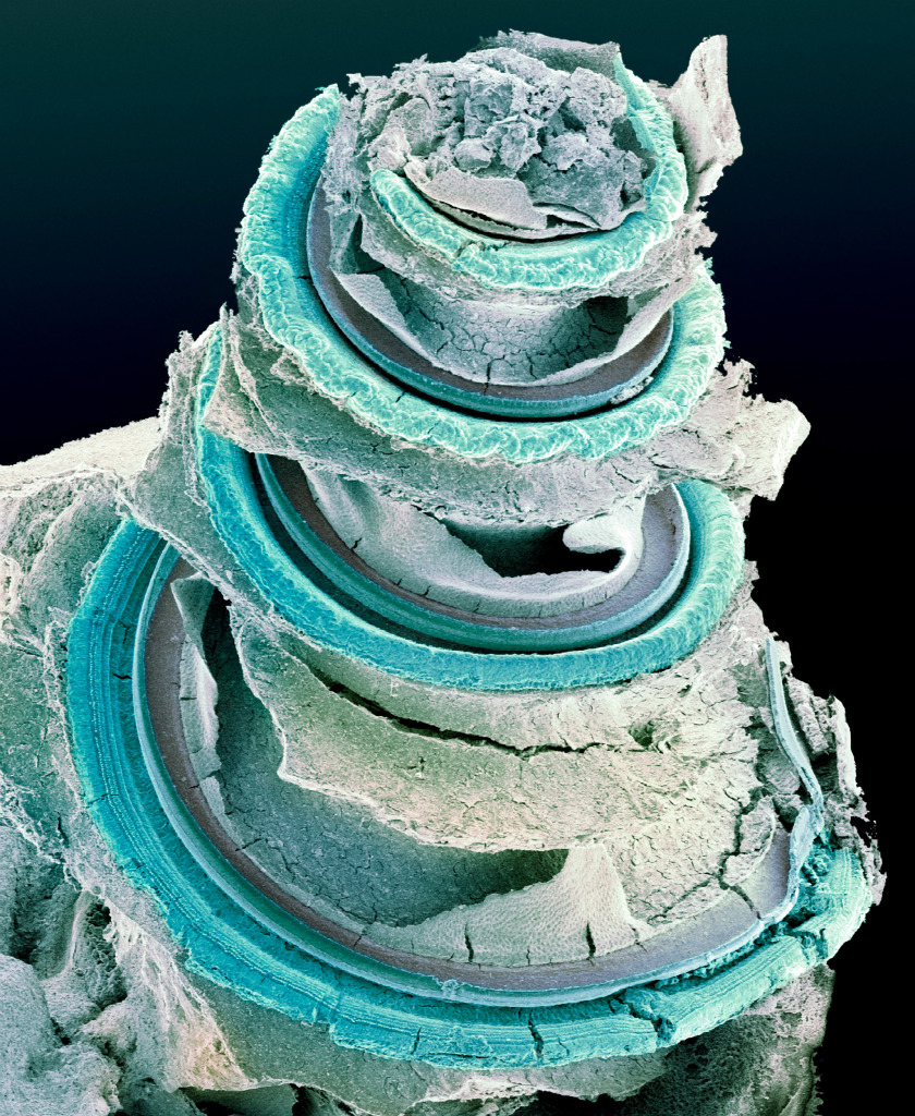 Organ of Corti, inner ear, SEM