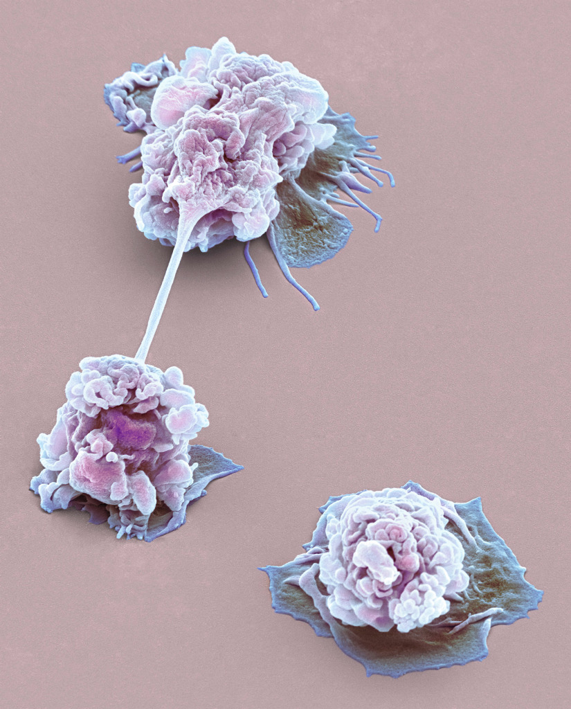 Activated granulocytes, SEM