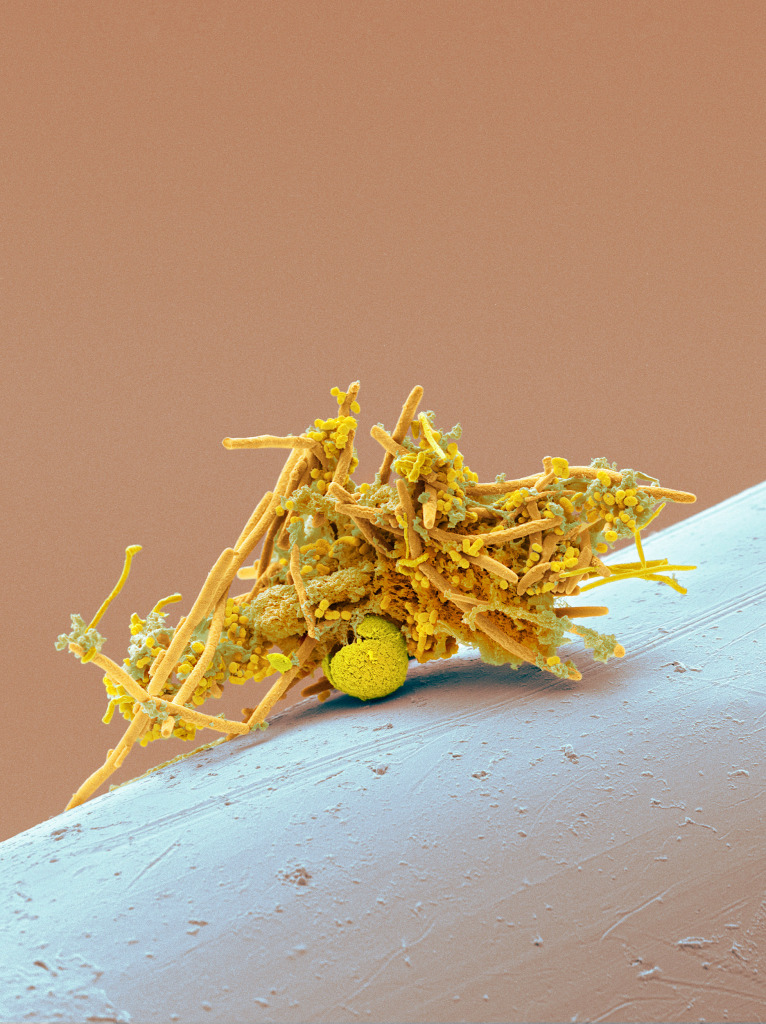 Used interdental brush, SEM