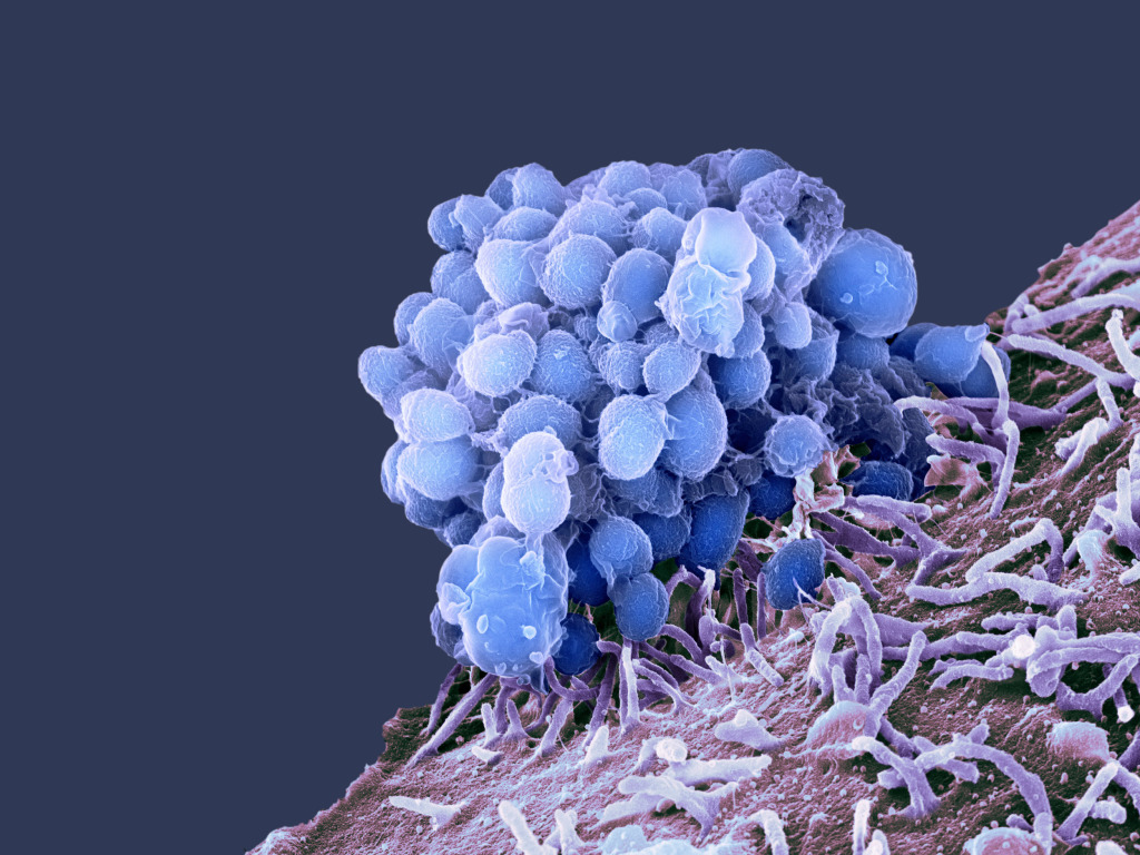 Gonorrhoea bacteria, SEM