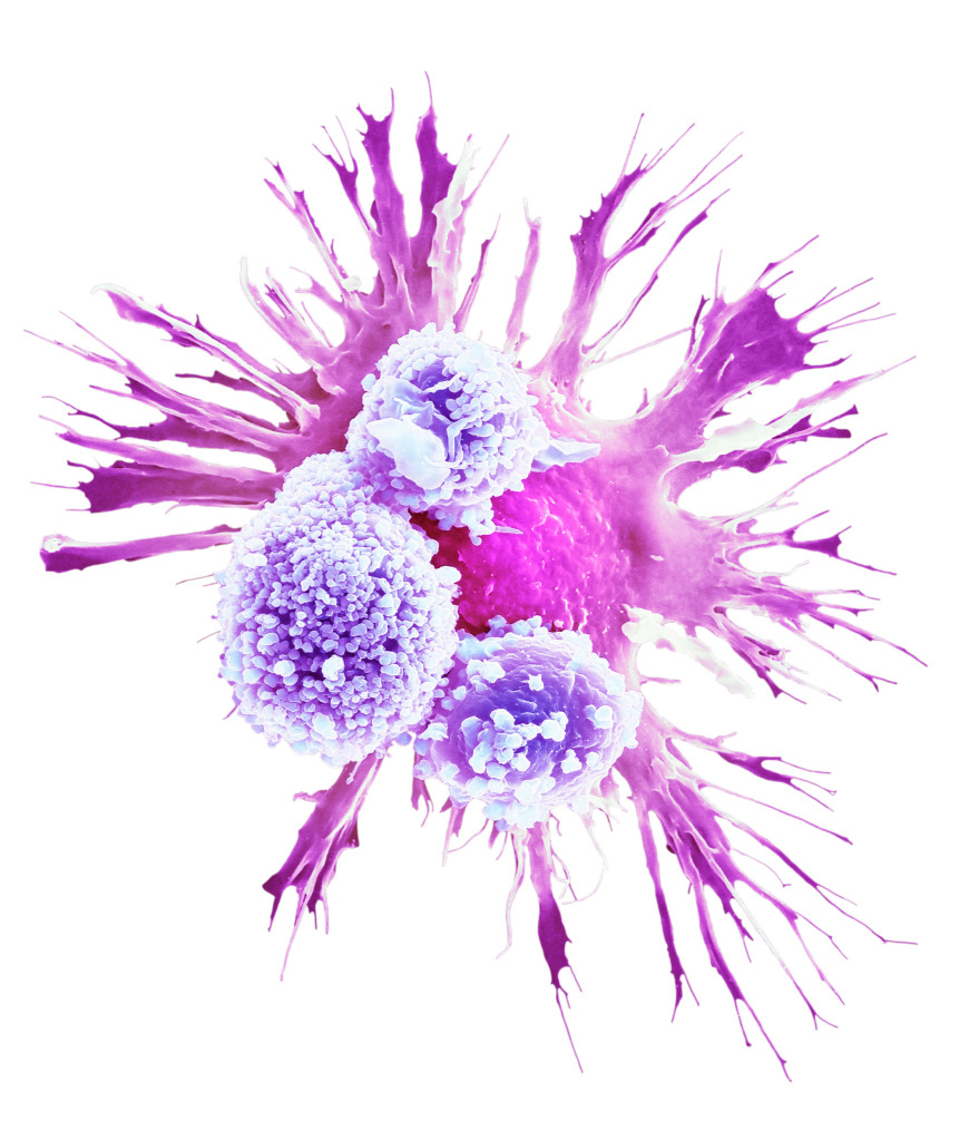 Alveolar macrophage, SEM