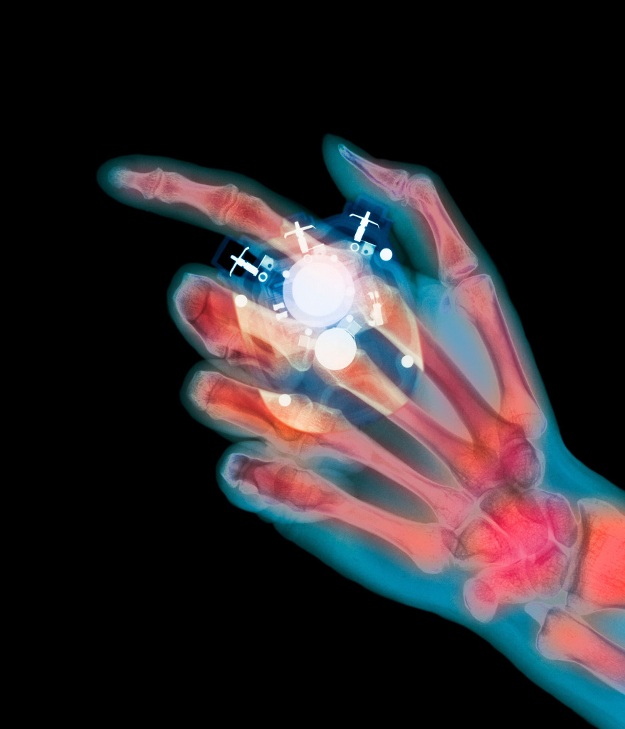 Coloured X-ray of a stopwatch held in a hand