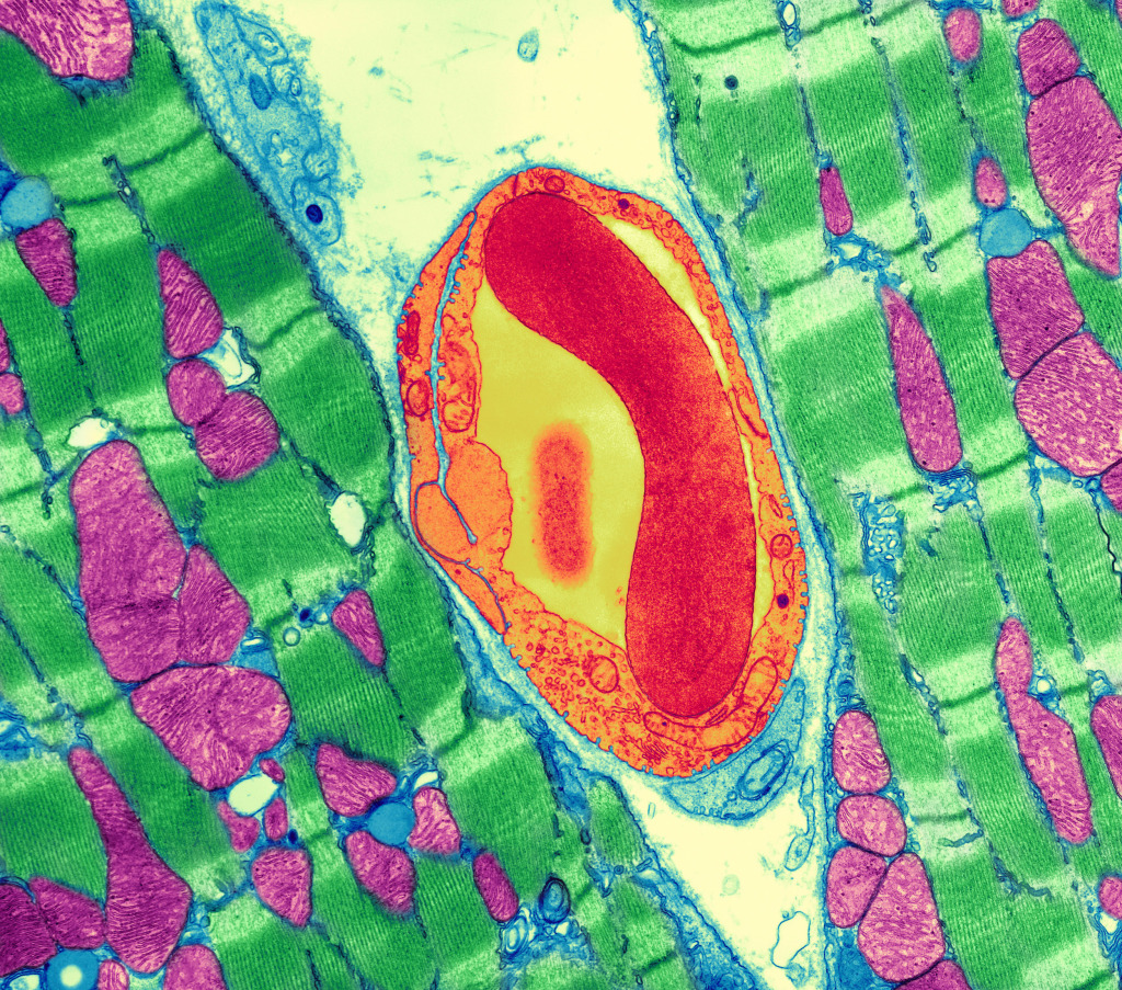 Cardiac muscle and capillary, TEM