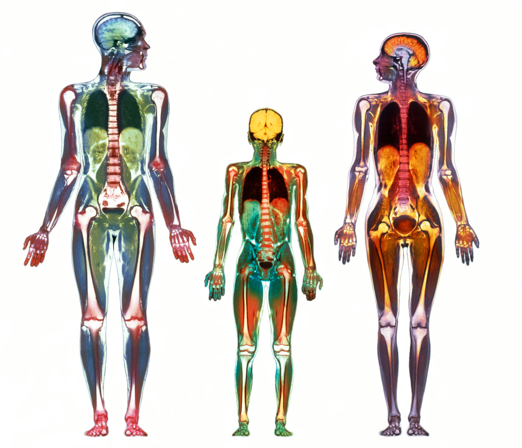 Whole body scans