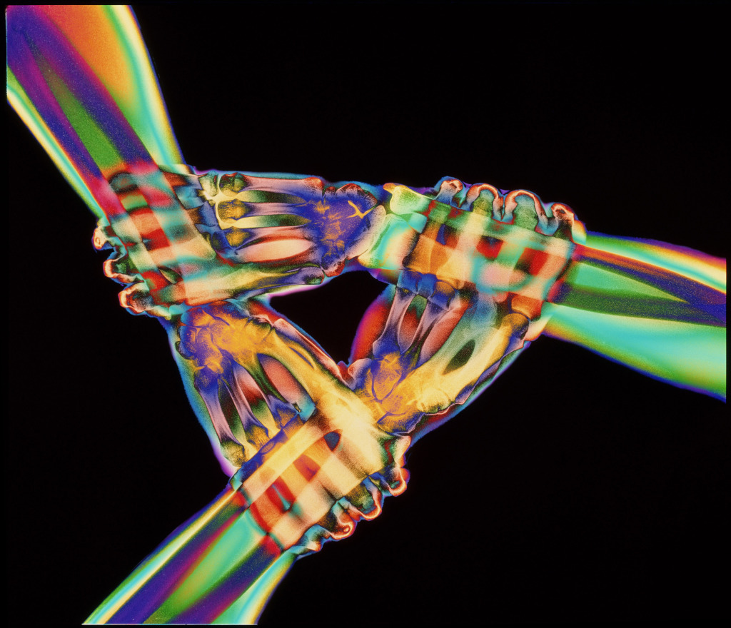 Coloured X-ray of a triangle of three linked hands