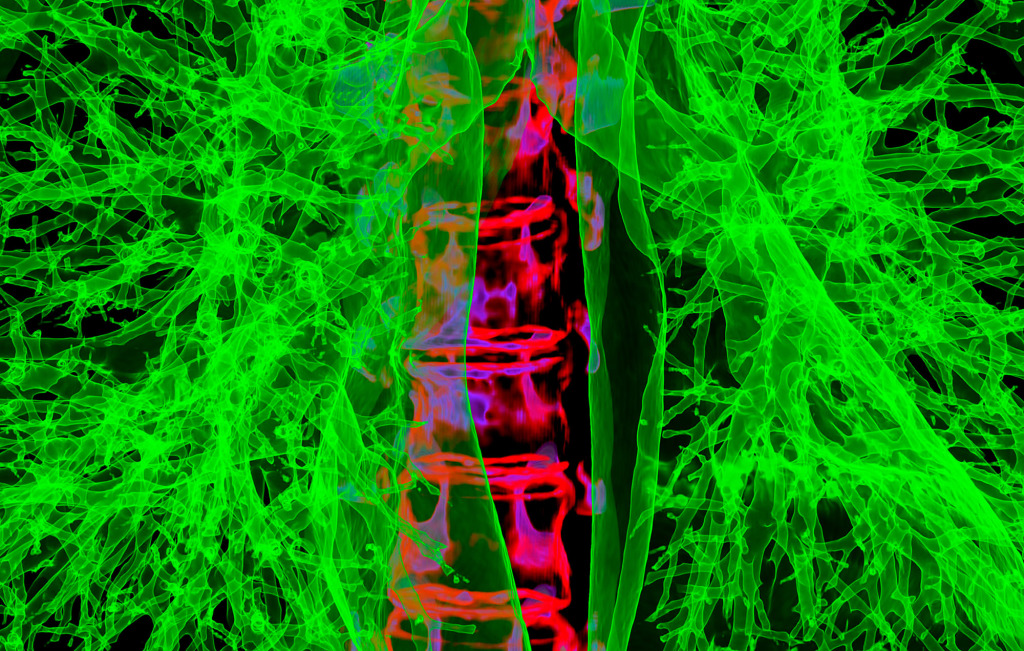 Lung airways and backbone, 3D CT scan