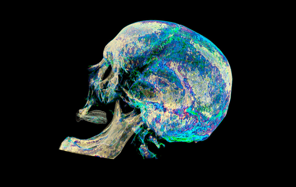 Human skull, 3D CT scan