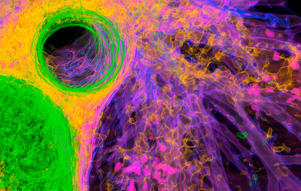 Lung airways, 3D CT scan