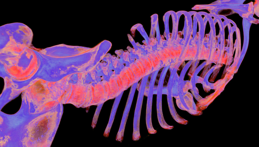 Bones of the torso, 3D CT scan