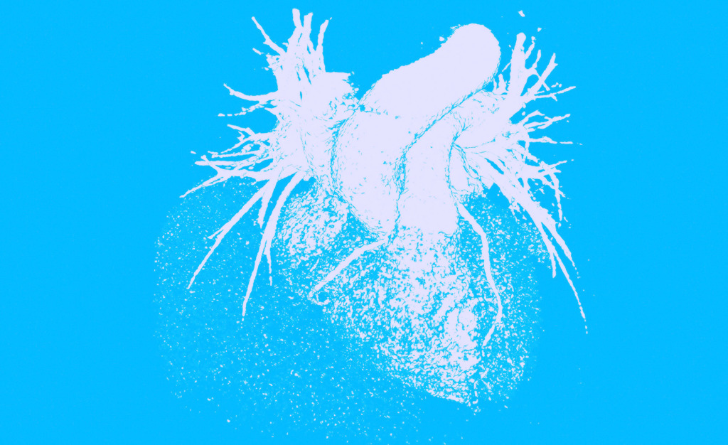 Healthy heart, 3D CT scan