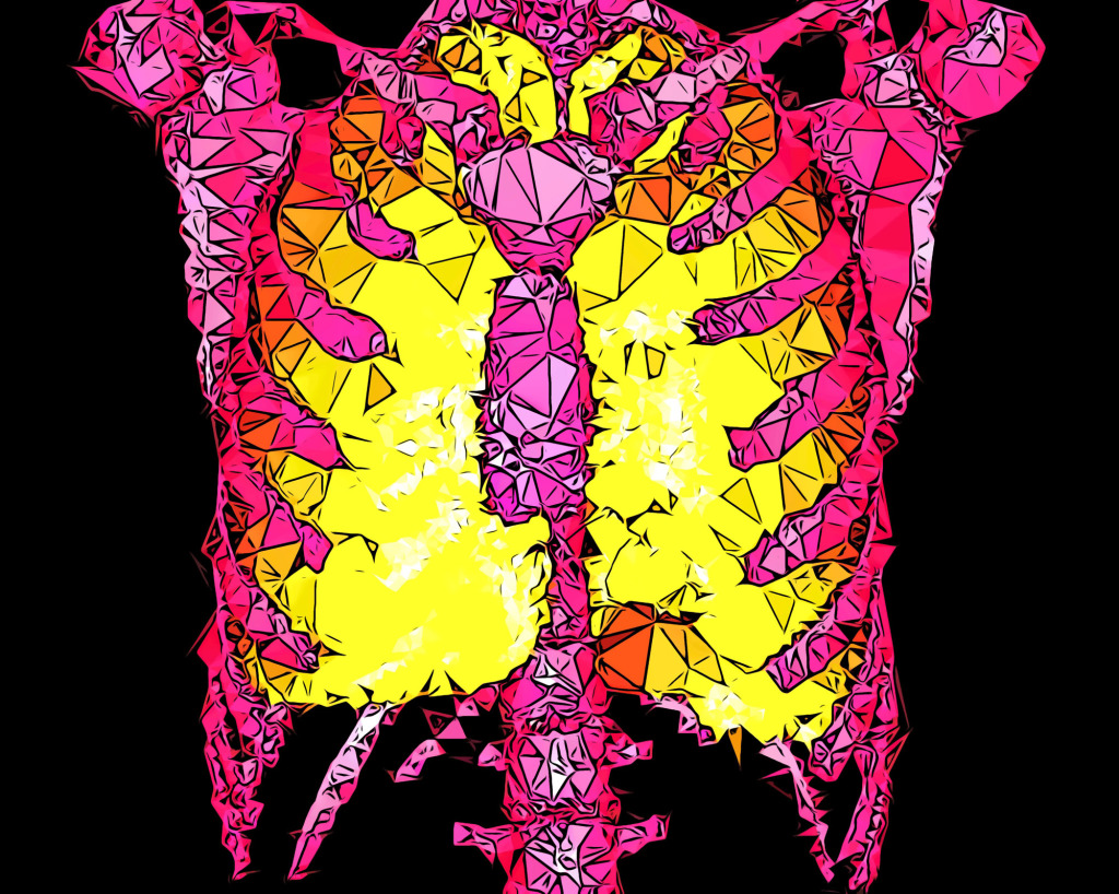 Lungs and ribs, CT scan
