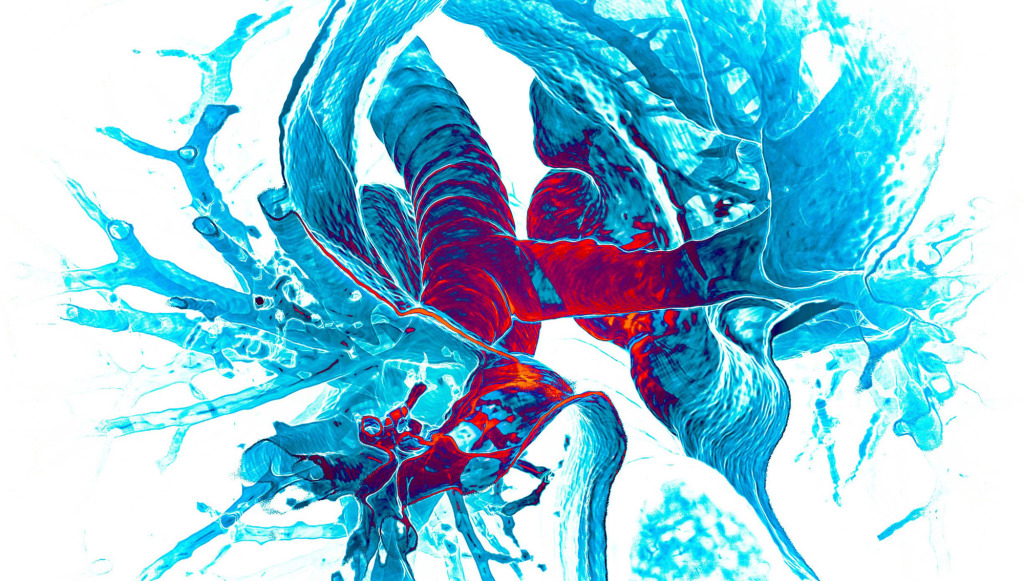 Healthy lungs, 3D CT scan