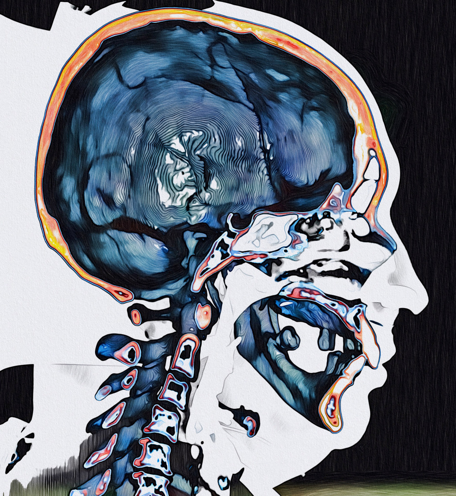 Bones of the skull and neck, CT scan
