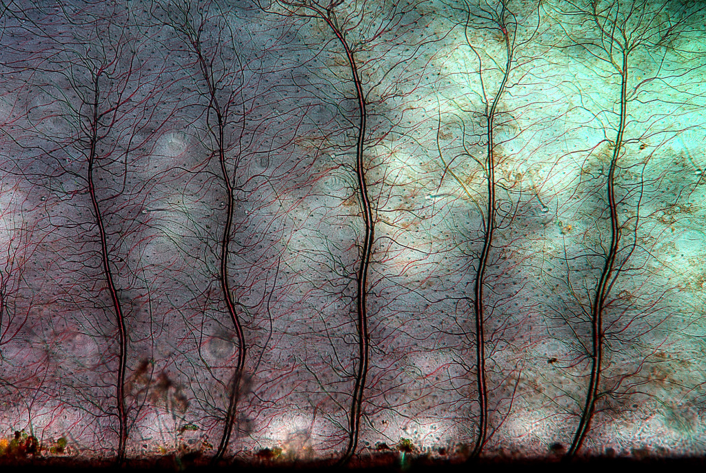 C0566663-Damselfly_larva_gill,_light_micrograph