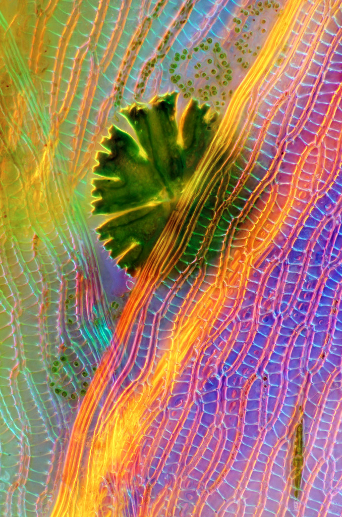 Desmid on sphagnum moss, light micrograph