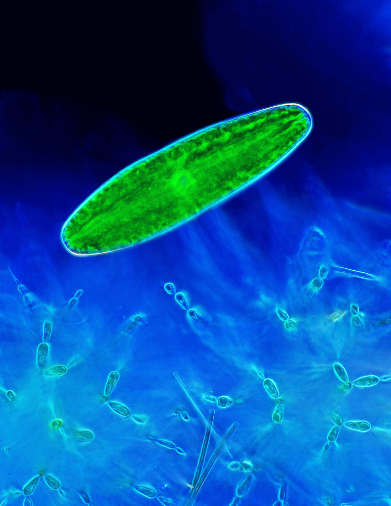 Desmid and red algae, light micrograph