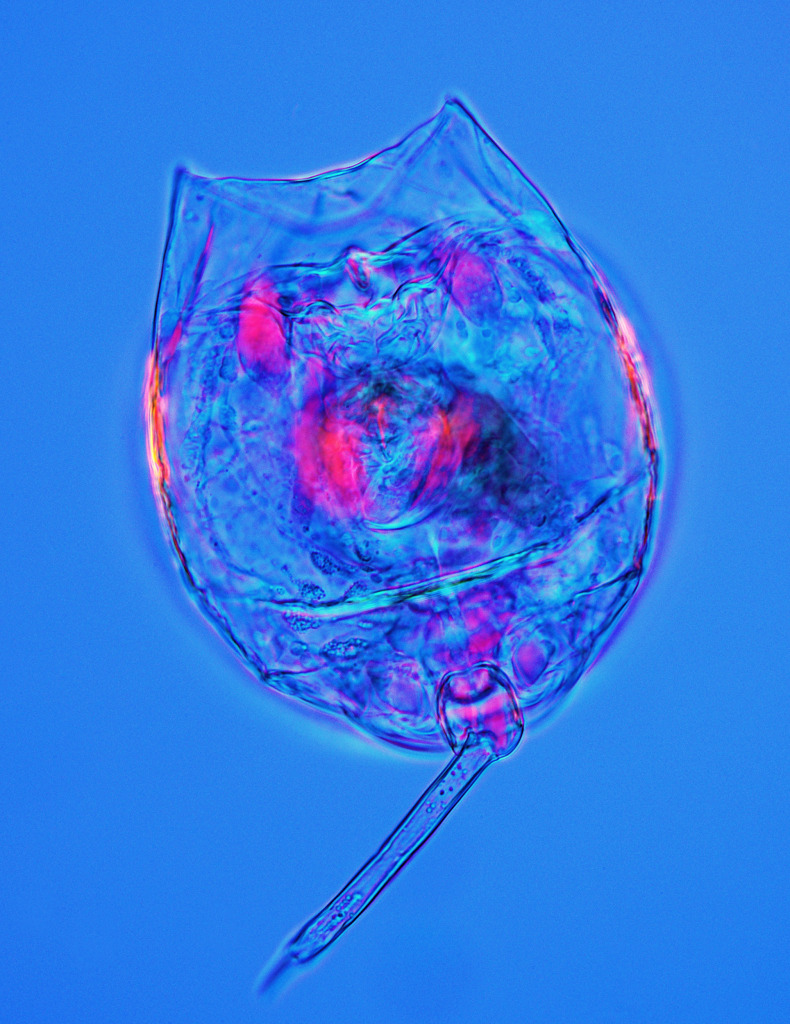 Rotifer, light micrograph