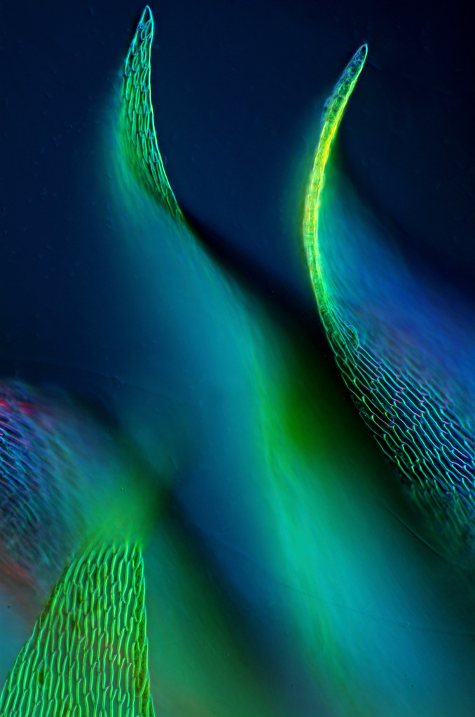 Sphagnum sp. moss, light micrograph