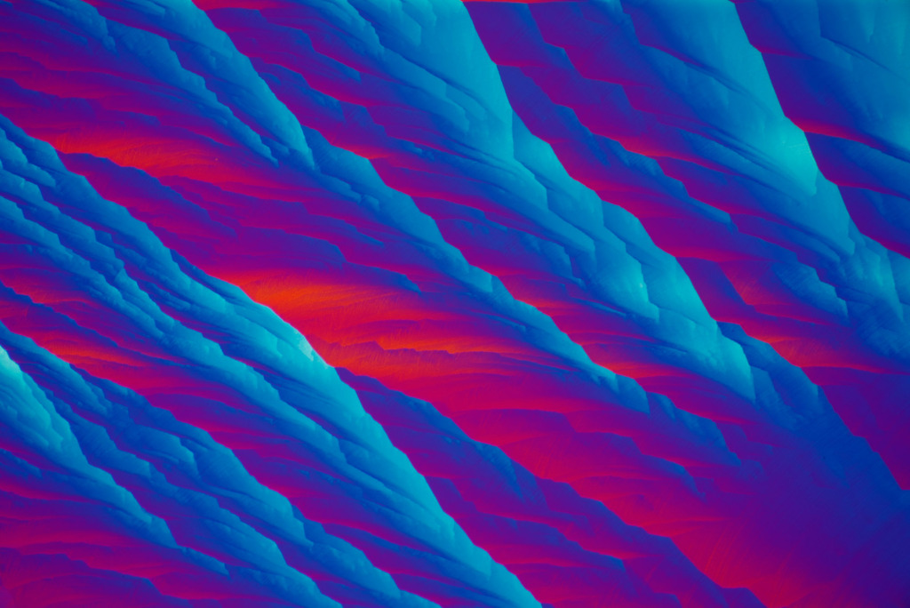 Callus remover crystals, light micrograph