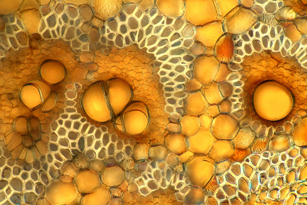 Banana stalk, light micrograph