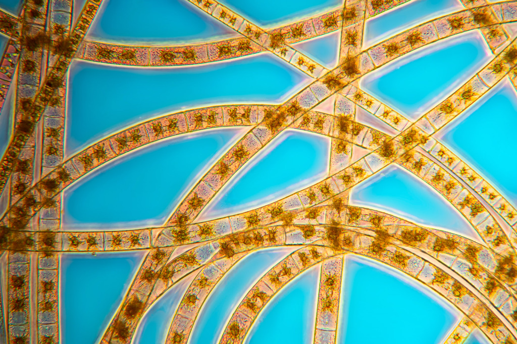 Different green algae, light micrograph