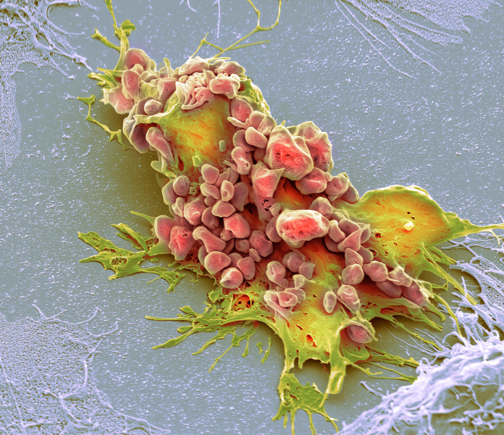 Chemotherapy induced cell death, SEM