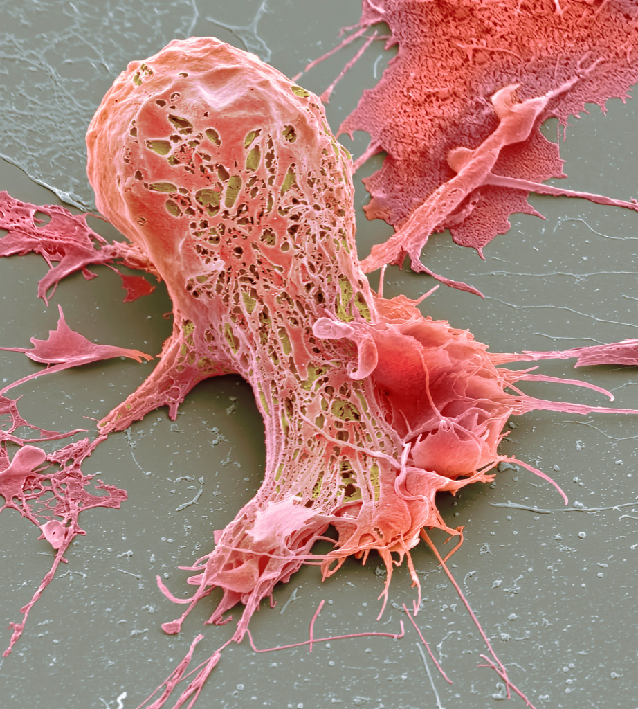 Chemotherapy induced cell death, SEM