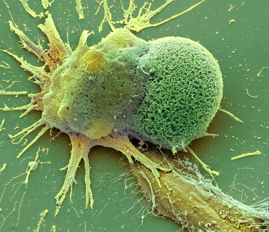 Chemotherapy induced cell death, SEM