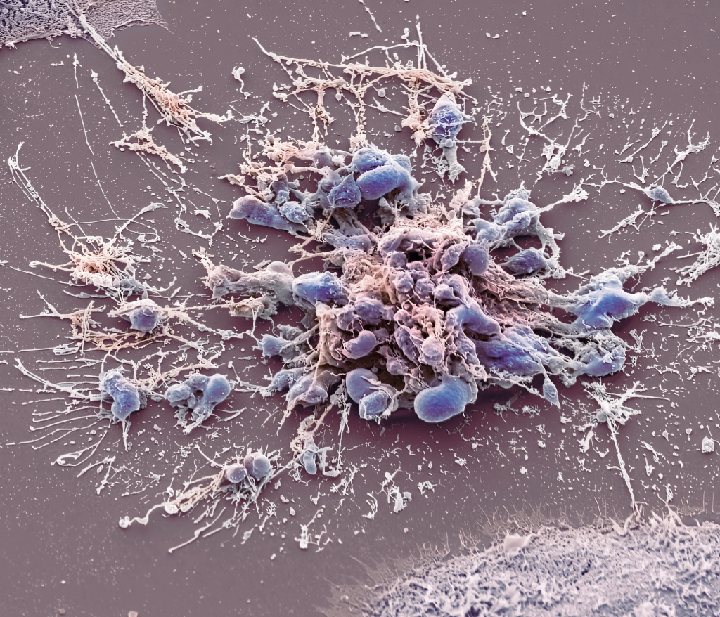 Chemotherapy induced cell death, SEM
