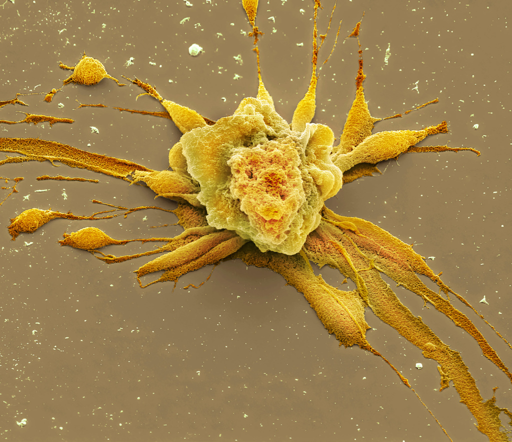 Chemotherapy induced cell death, SEM