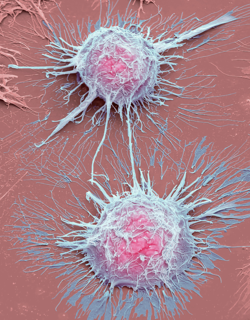 Dividing HeLa cells, SEM