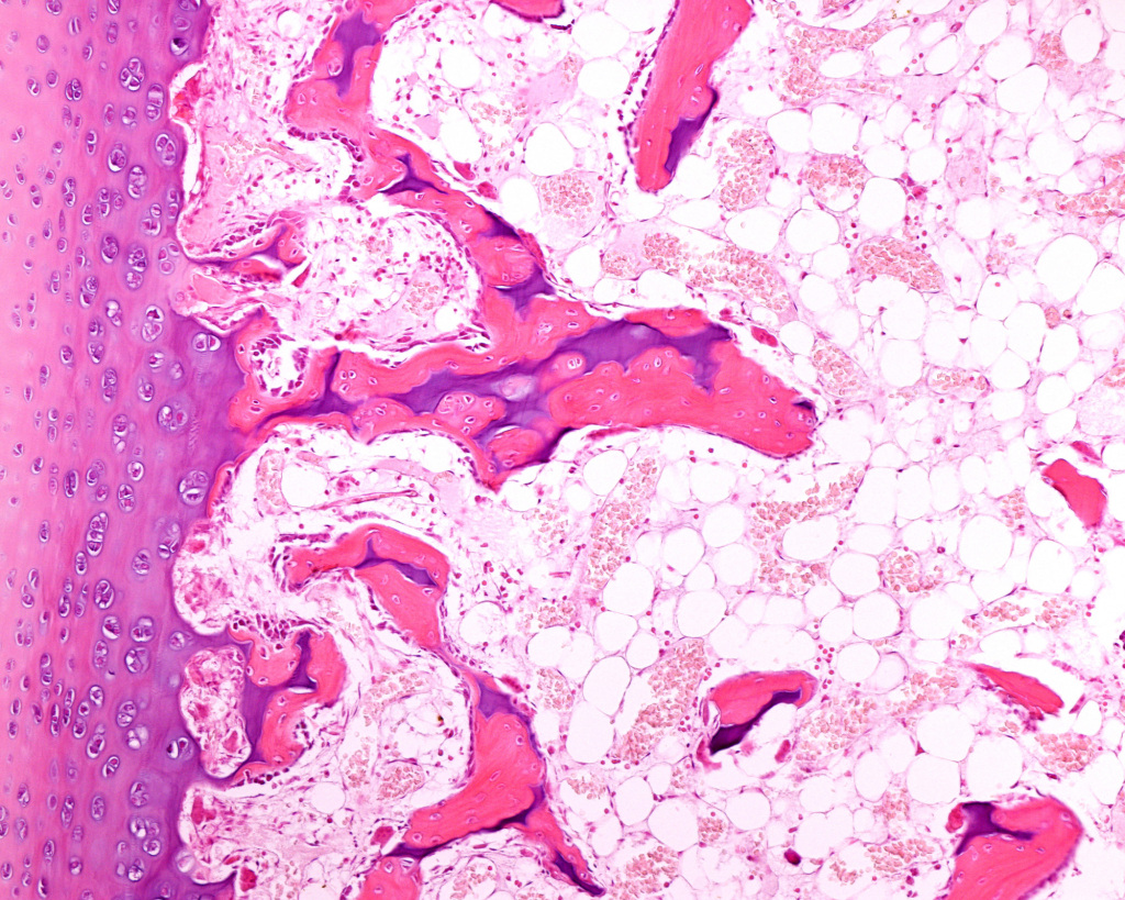 Developing bone, light micrograph
